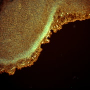 Harpagifer fin cell culture growing out: Harpagifer fin cell culture growing out