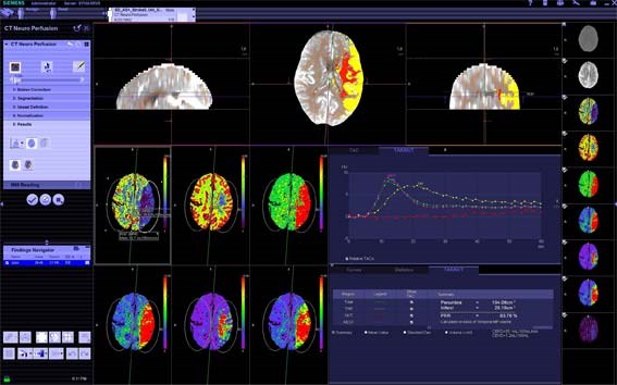 New version of syngo via helps increase diagnostic efficiency: rsna_syngo_via_va20.jpg