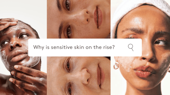 The Sensitive Skin Surge: Why More of Us Are Reacting and How to Calm the Chaos: Sensitive Skin-2