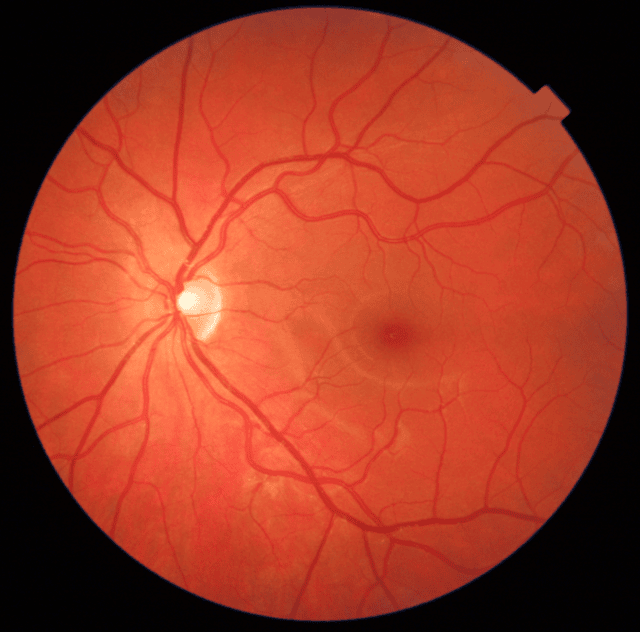 Retina image courtesy of SCONe