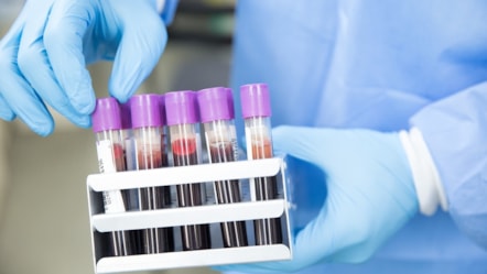 PCSM Research Hub