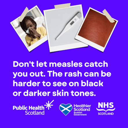 MMR Against Measles (Asset 8) May 2025