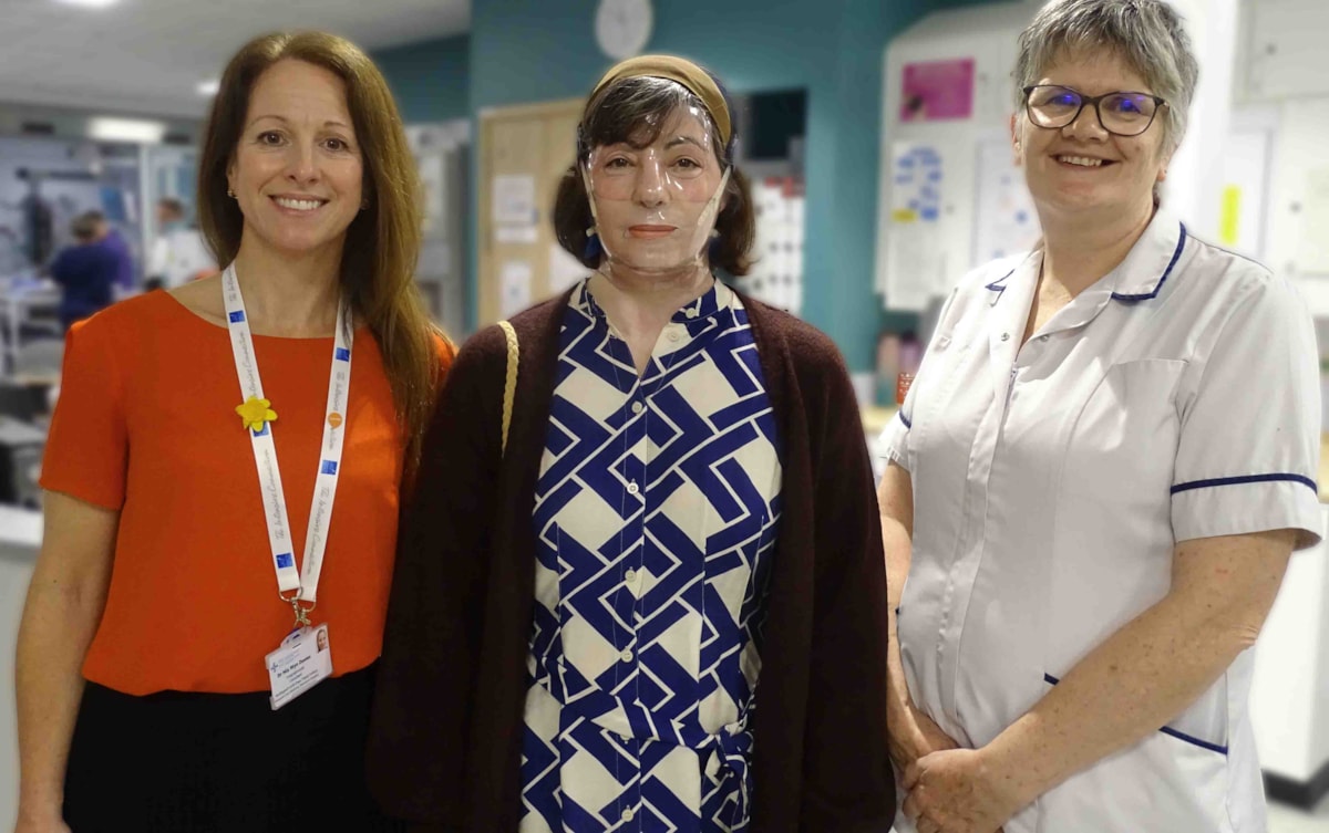 Sian Morgan with consultant intensivist Nia Wyn Davies and burns clinical specialist physiotherapist Menna Davies