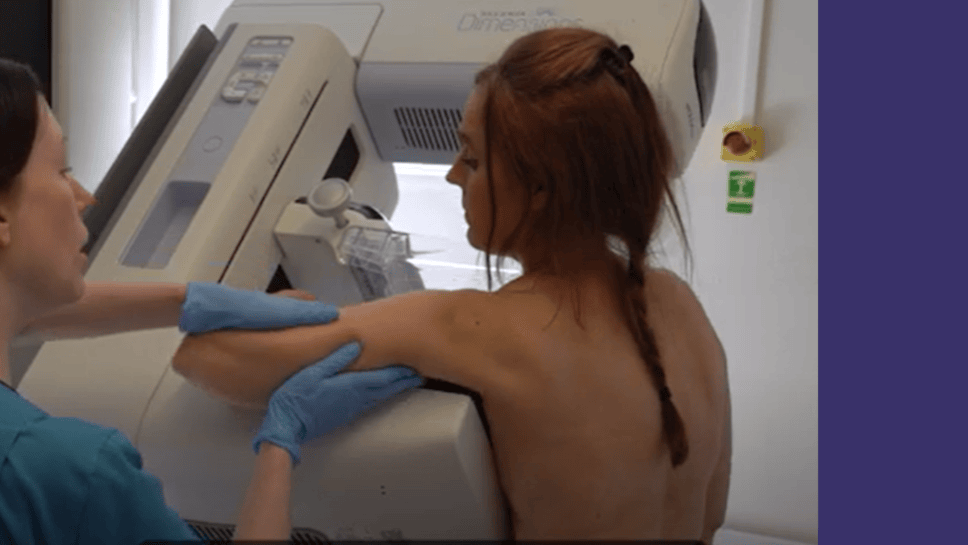 Breast Screening: What to Expect Hero Image