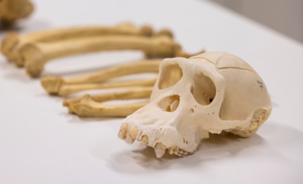 Choppers' remains are examined the National Museums Collections Centre in Edinburgh. Photo Duncan McGlynn (2)