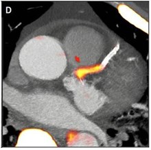 innovations-in-pet-ct-full-size.jpg