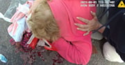 Margaret Scaldwell injury 2: Margaret Scaldwell injury 2
