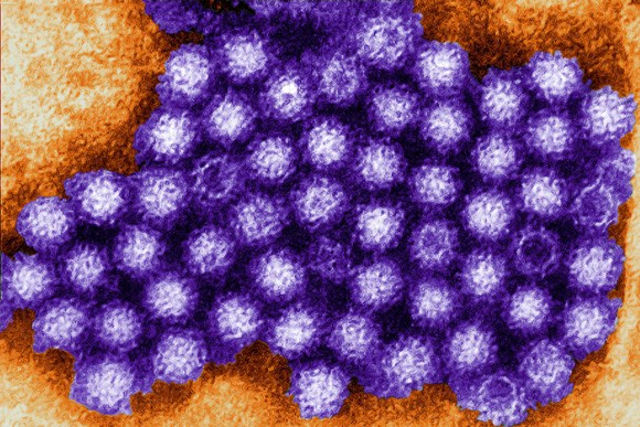 Norovirus advice and update: s960 norovirus