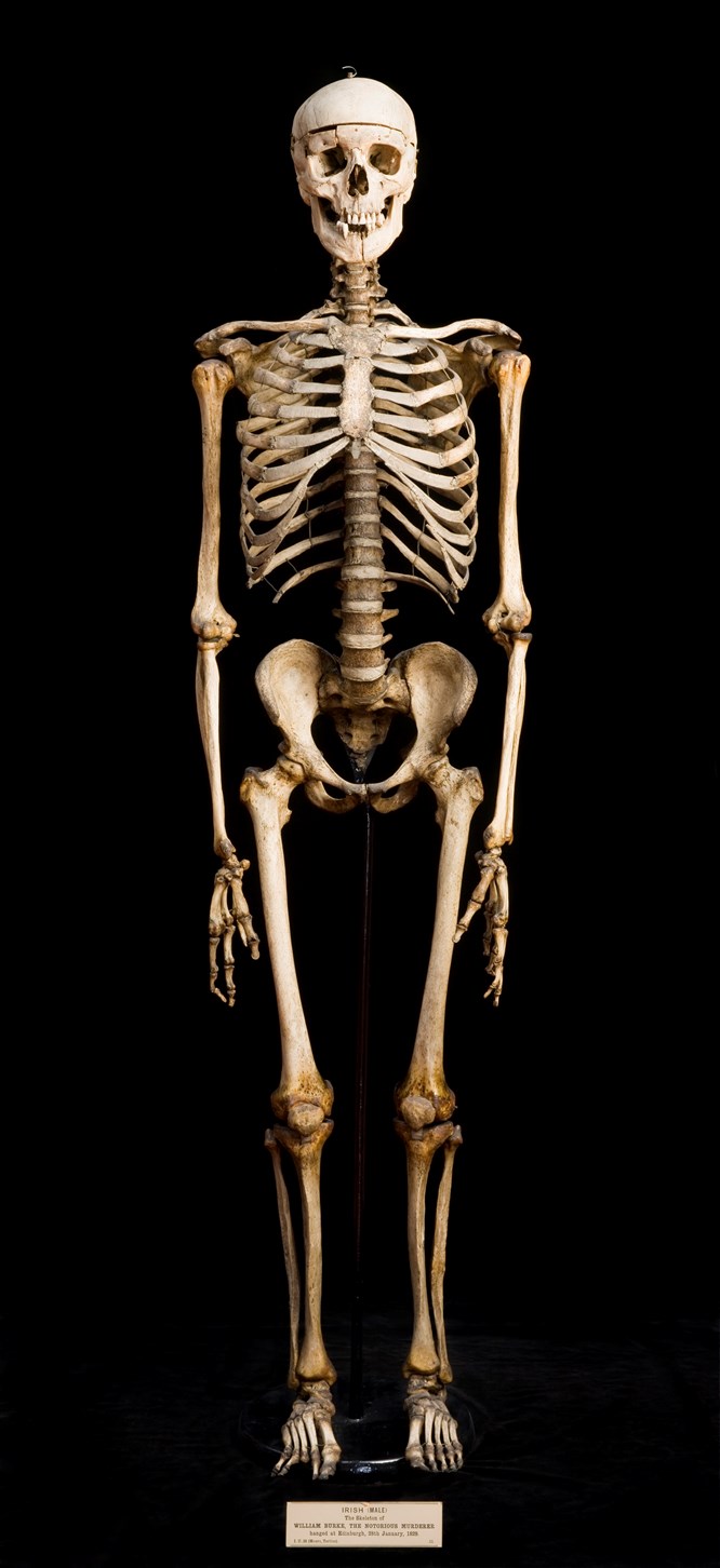 Skeleton of William Burke. Image copyright Anatomical Museum collection ...