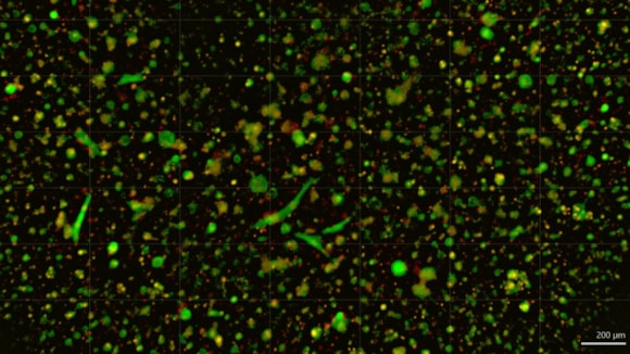 ChristianaCare Launches Organoid Core to Personalize Cancer Treatment: carboplatin treatment 4 zoomed 2