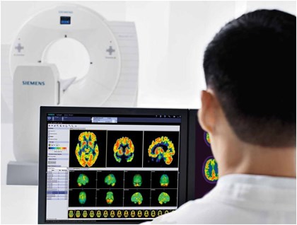 Siemens Healthcare welcomes dementia summit with Alzheimer’s imaging solutions: siemens-healthcare-dementia-summit.jpg