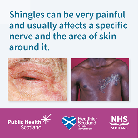 Shingles Vaccine (Static 1B) - December 2023