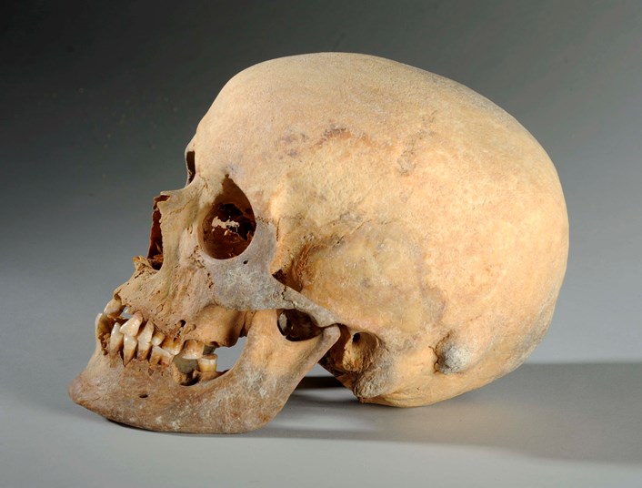 Object of the week- 2,000 year old skull: leedm.d.2010.0012.001.006e.jpg