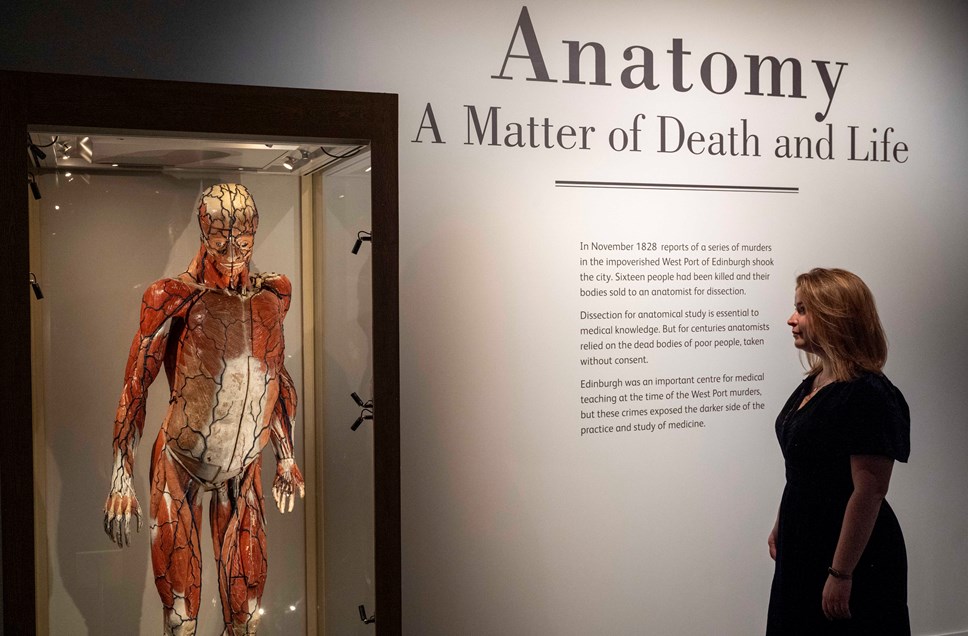 Curator Sophie Goggins with a rare anatomical model by Louis Auzouz, 19th-century. Photo © Neil Hanna (1) (1)