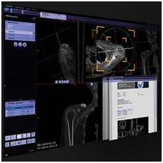 New version of syngo.via brings anatomical intelligence to diagnostic reading: syngo-via-va30-full-size.jpg