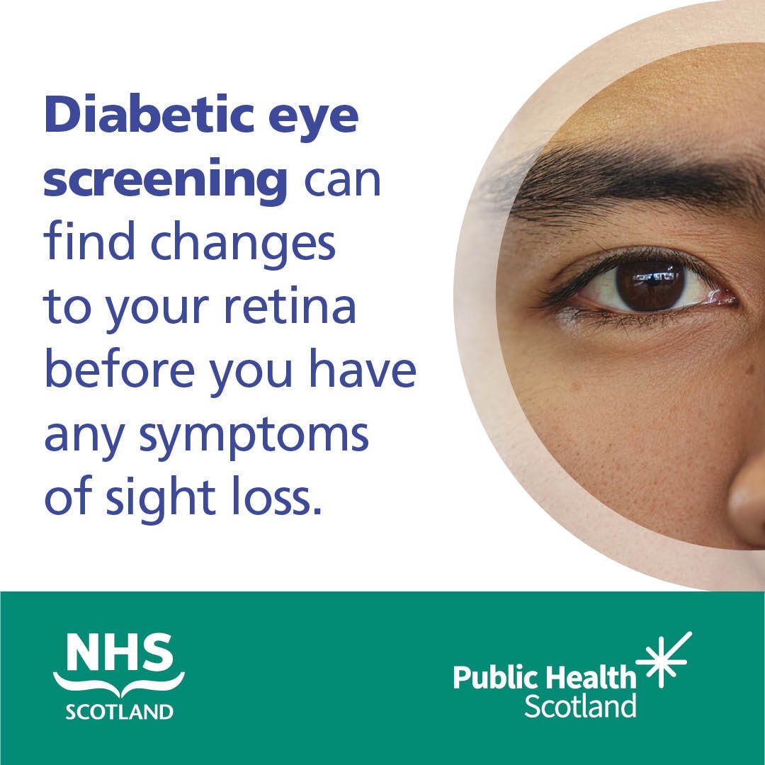 Diabetic Eye Screening Asset 2