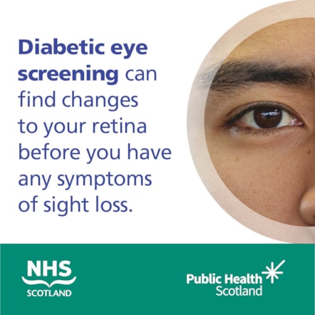 Diabetic Eye Screening Asset 2