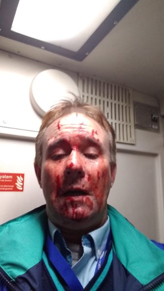 Ian Birch - Injuries